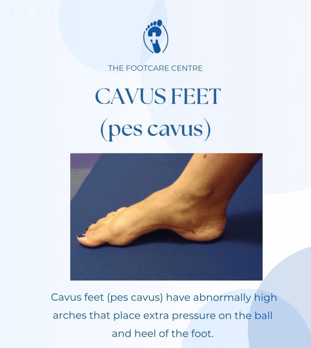 Foot Health Education | The Foot Care Centre